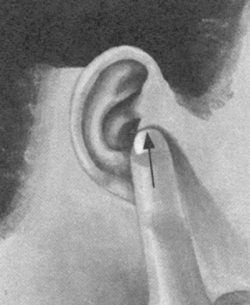 鼻炎按摩部位图解