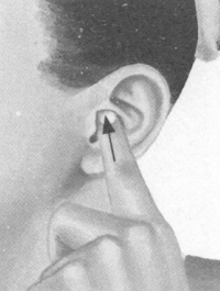 肥胖症按摩部位图解