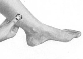 糖尿病按摩部位图解