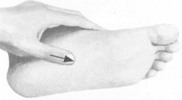 风湿病按摩部位图解