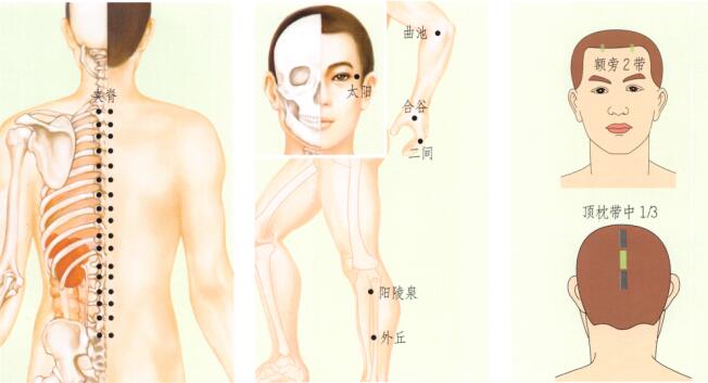 带状孢疹刮痧部位图解