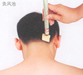 斑秃艾灸哪个部位图解