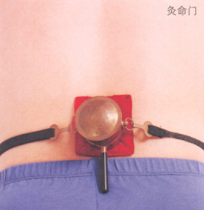 慢性腰肌劳损艾灸哪个部位图解