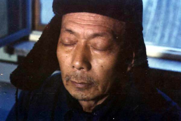 中医望目之目睛突起