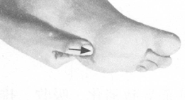 咽喉炎按摩部位图解