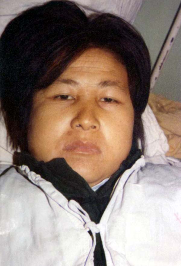 中医望色之黄浊，面浮胖