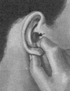 耳鸣-耳痛按摩部位图解