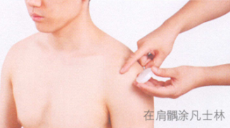 中风后遗症艾灸哪个部位图解