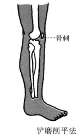 小针刀的运刀方法