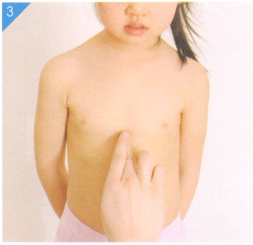 小儿荨麻疹按摩部位图解