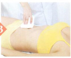 排毒通便拔罐部位图解