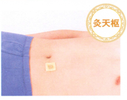 腹泻艾灸哪个部位图解