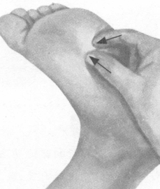 肩周炎按摩部位图解