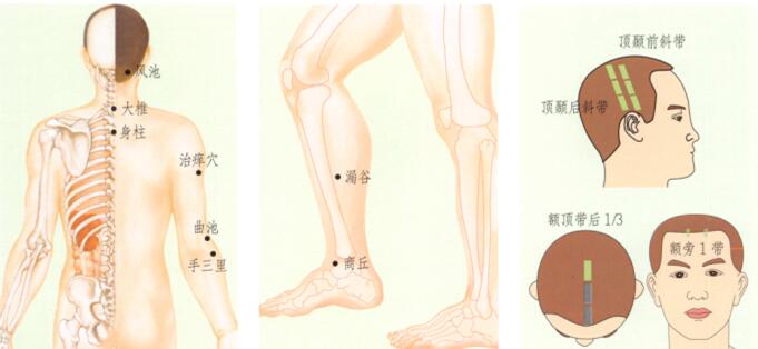 皮肤瘙痒症刮痧部位图解