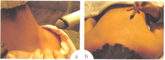 祛除黄褐斑艾灸哪个部位图解