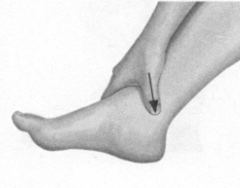 咽喉炎按摩部位图解