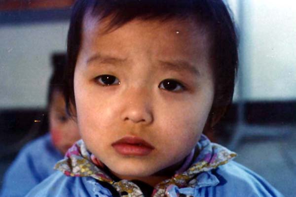 中医望色之面色苍白