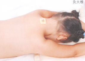 百日咳艾灸哪个部位图解