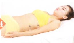 痰湿体质拔罐部位图解