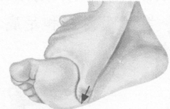 失眠症按摩部位图解