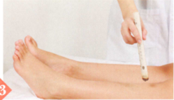 反流性食管炎艾灸哪个部位图解