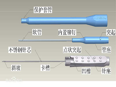 浮针治疗顽固性面瘫