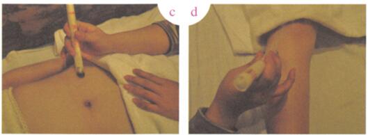 小儿积食艾灸哪个部位图解