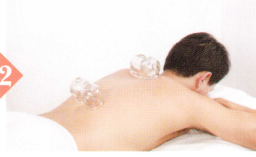 肥胖症拔罐部位图解