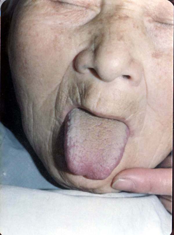 中医望色之面青灰