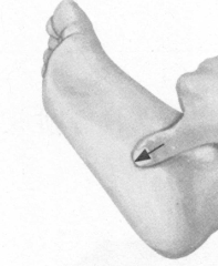 胃肠炎按摩部位图解