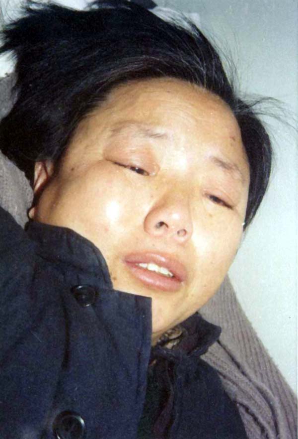 中医望神之脏躁