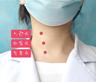 针刺三穴改善甲状腺功能
