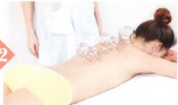 青光眼拔罐部位图解