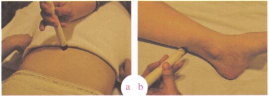 子宫脱垂艾灸哪个部位图解