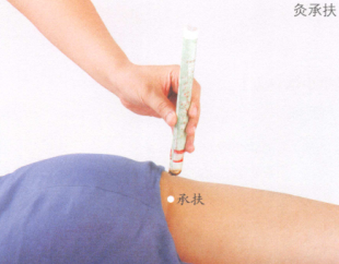 坐骨神经痛艾灸哪个部位图解