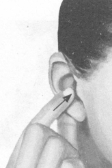 颈椎病按摩部位图解