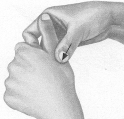 风湿病按摩部位图解