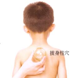 百日咳刮痧部位图解