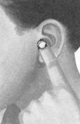 高脂血症按摩部位图解