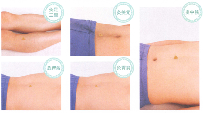 胃下垂艾灸哪个部位图解