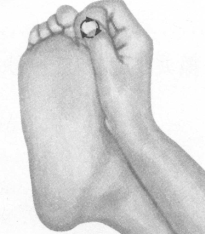 腰椎间盘突出症按摩部位图解