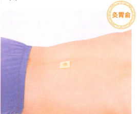 呕吐艾灸哪个部位图解