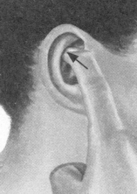 更年期综合征按摩部位图解