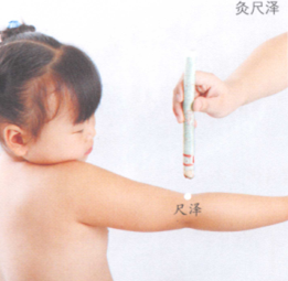 百日咳艾灸哪个部位图解