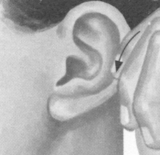 风湿病按摩部位图解