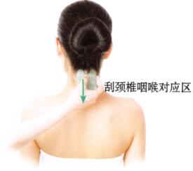 咽喉肿痛刮痧部位图解