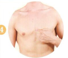 冠心病拔罐部位图解