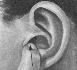 咽喉炎按摩部位图解