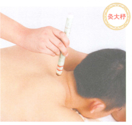 类风湿性关节炎艾灸哪个部位图解