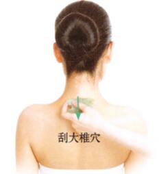 扁平疣刮痧部位图解